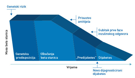 Grafički prikaz hipotetskih stupnjeva razvoja dijabetesa tip 1