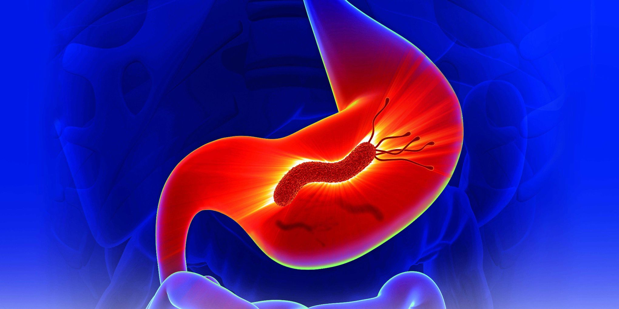 гастродуоденит хеликобактер. гастрит ассоциированный с helicobacter pylori, относится к. гастрит бактерия helicobacter. язвенная болезнь хеликобактер пилори. гастрит хеликобактер пилори.