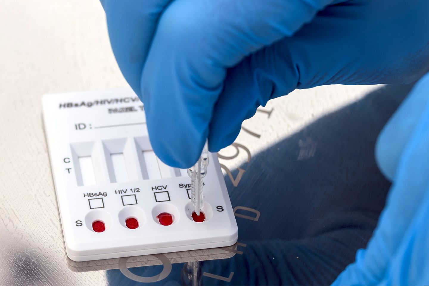 Slika prikazuje zdravstvenog radnika u laboratoriju sa zaštitnim rukavicama koji nanosi uzorke krvi na brzu višepanelnu dijagnostičku testnu kasetu za probir na HIV, hepatitis B, hepatitis C i sifilis.