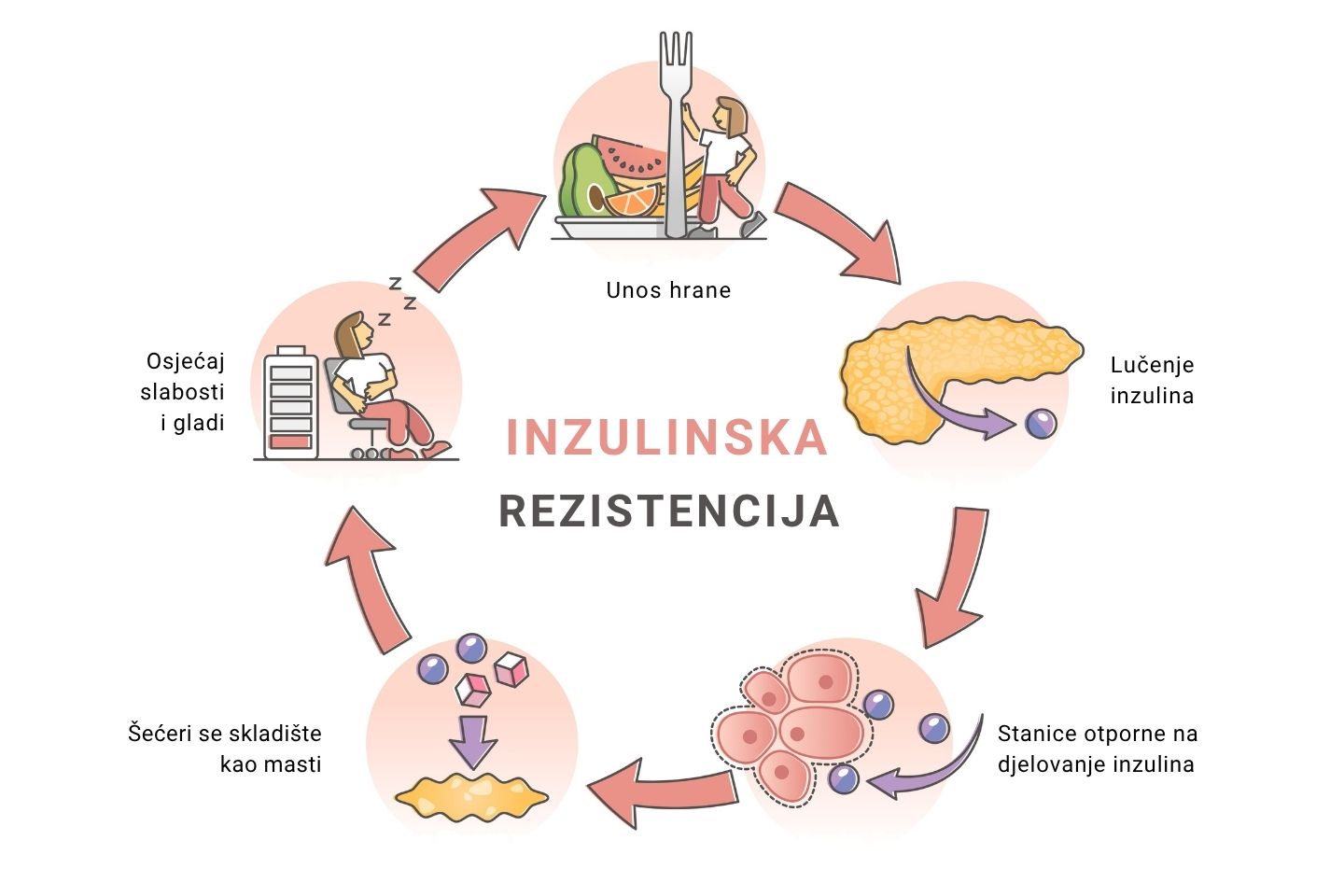 Ilustrativni prikaz procesa kod inzulinske rezistencije.