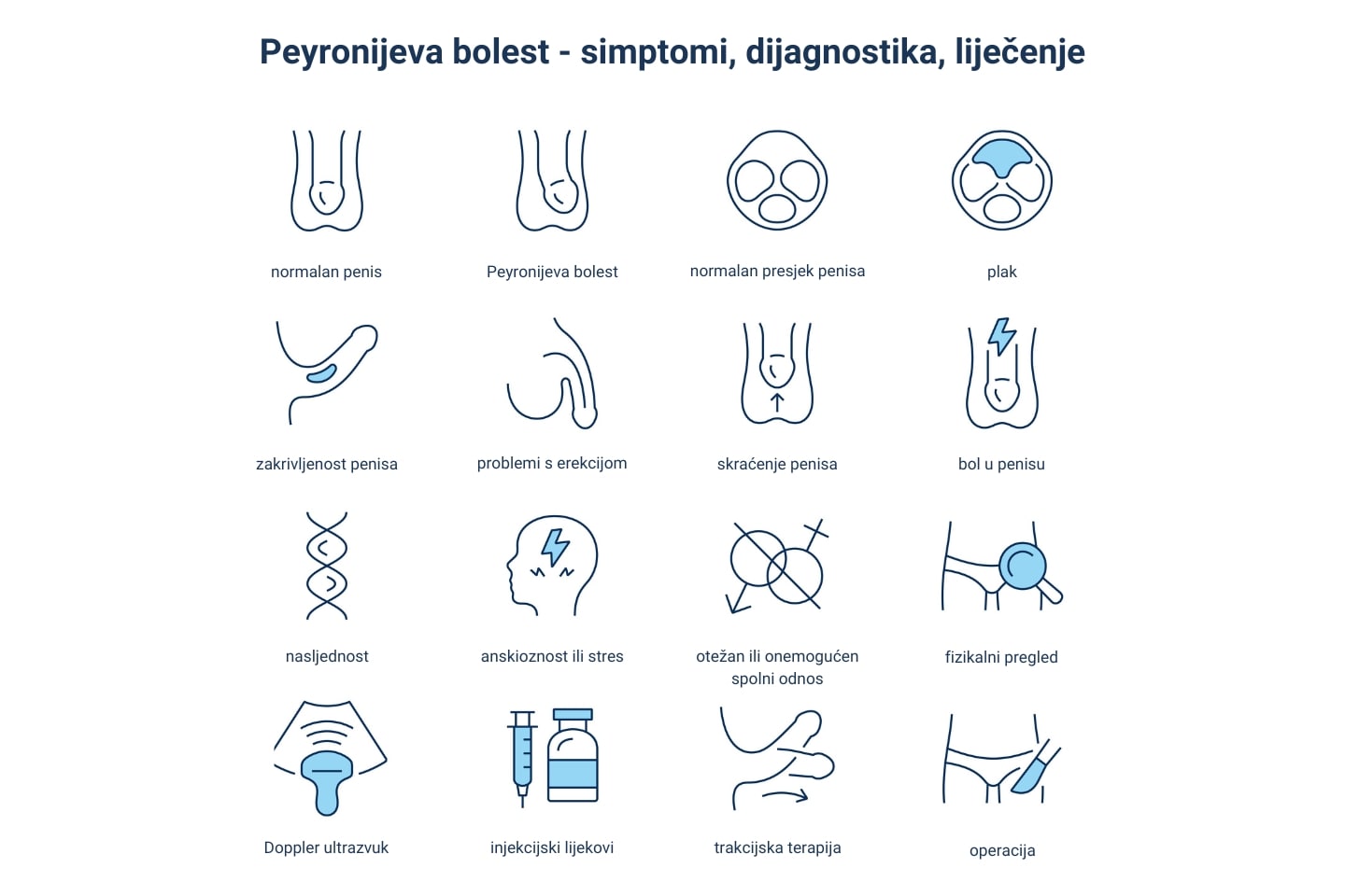 Infografika - pregled simptoma, dijagnostike i liječenja Peyronijeve bolesti