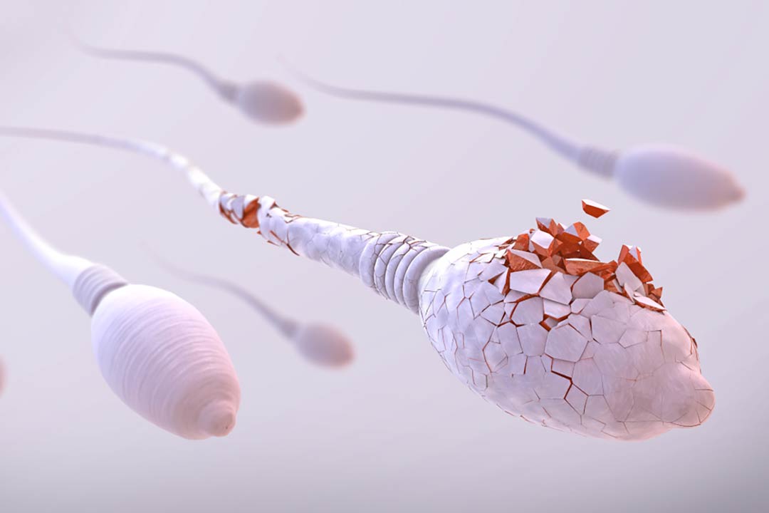 Ilustrativni prikaz oštećenog spermija