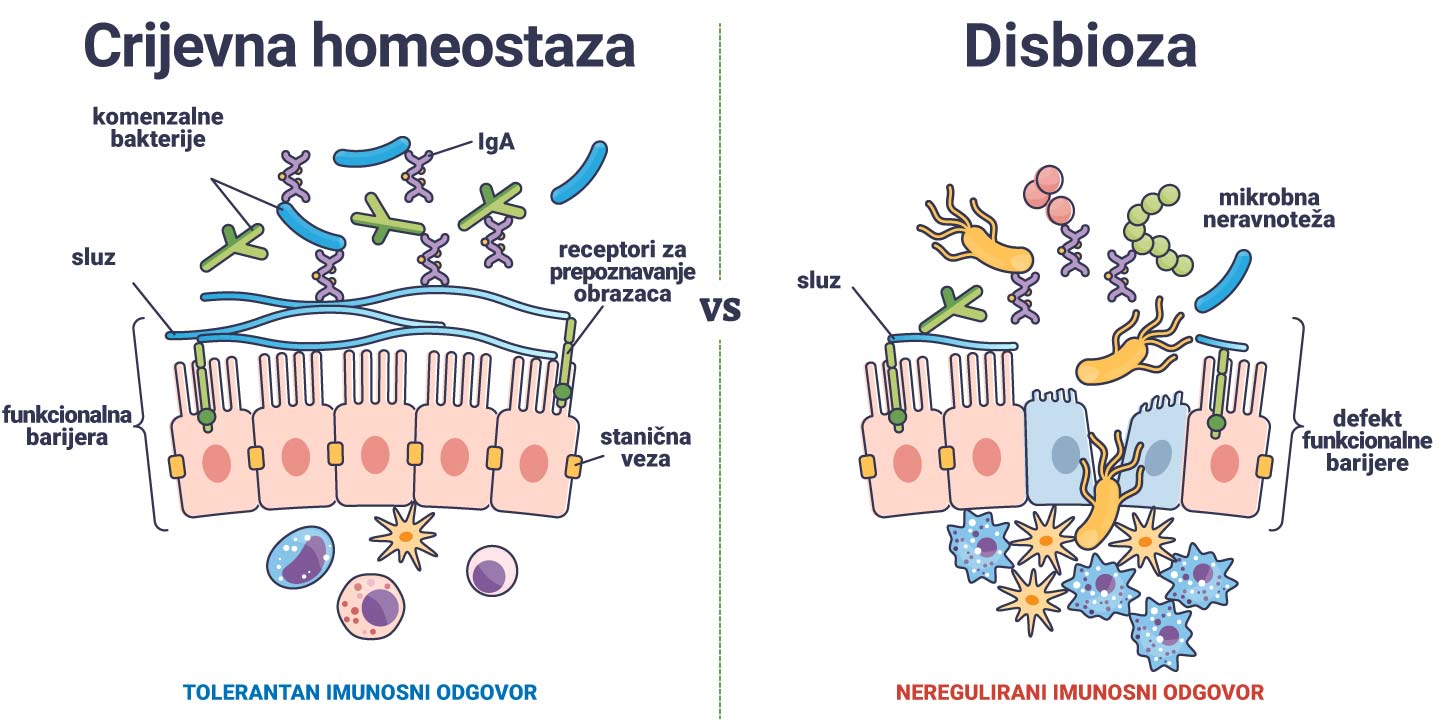 Crijevna homeostaza vs disbioza - razlike